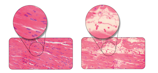 edema-webnew