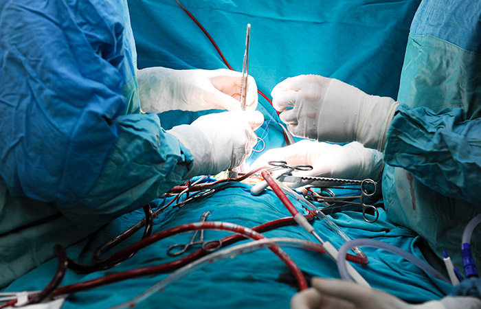mps3-surgeons-1